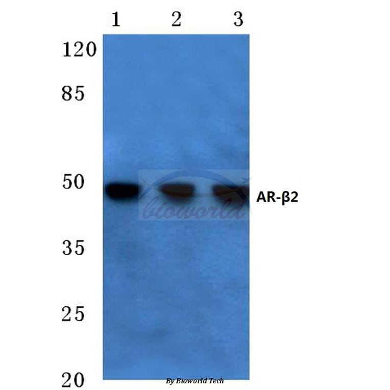 Anti-AR-β2 (L342) Antibody from Bioworld Technology (BS1716) - Antibodies.com