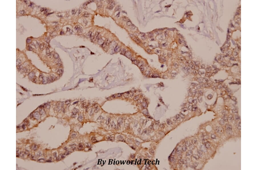 Anti-AR-β2 (L342) Antibody from Bioworld Technology (BS1716) - Antibodies.com