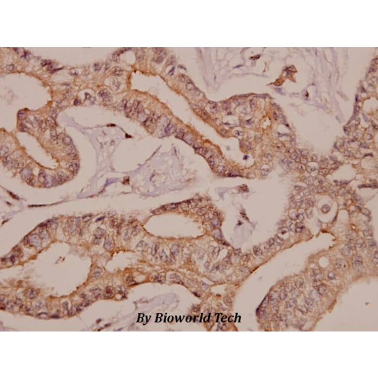 Anti-AR-β2 (L342) Antibody from Bioworld Technology (BS1716) - Antibodies.com