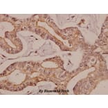 Anti-AR-β2 (L342) Antibody from Bioworld Technology (BS1716) - Antibodies.com