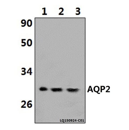 Anti-AQP2 (R252) Antibody from Bioworld Technology (BS1718) - Antibodies.com