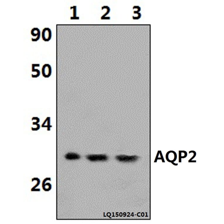 Anti-AQP2 (R252) Antibody from Bioworld Technology (BS1718) - Antibodies.com