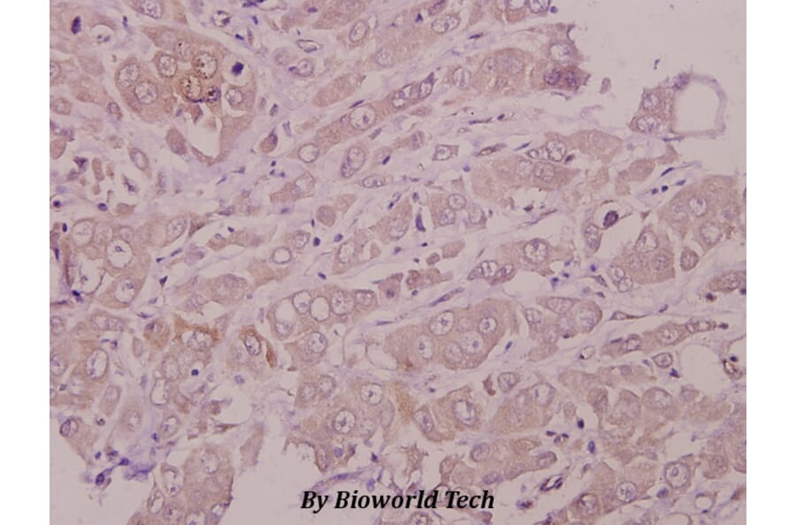 Anti-AQP2 (R252) Antibody from Bioworld Technology (BS1718) - Antibodies.com