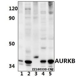 Anti-AURKB (Y8) Antibody from Bioworld Technology (BS1722) - Antibodies.com