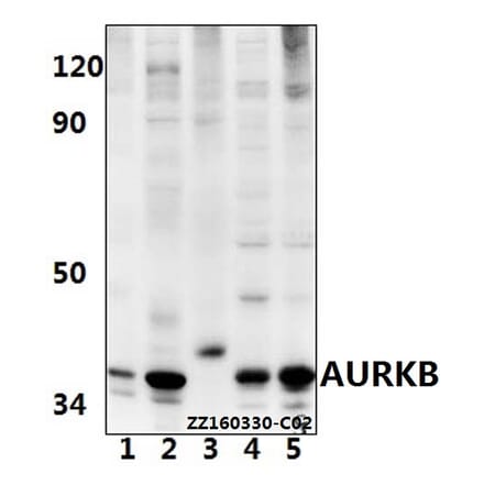 Anti-AURKB (Y8) Antibody from Bioworld Technology (BS1722) - Antibodies.com