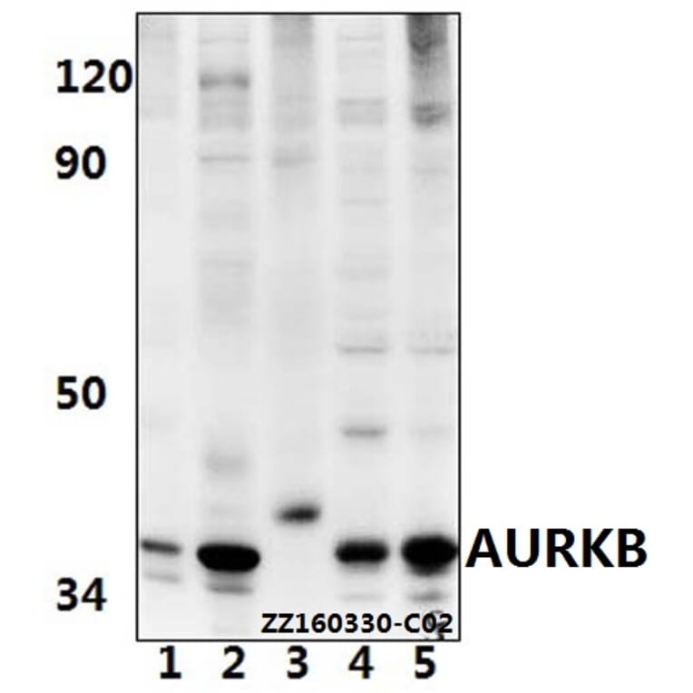 Anti-AURKB (Y8) Antibody from Bioworld Technology (BS1722) - Antibodies.com
