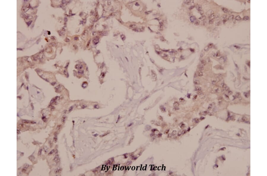 Anti-Bad (P130) Antibody from Bioworld Technology (BS1724) - Antibodies.com