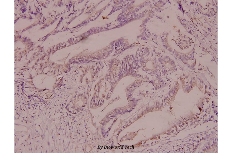 Anti-CaMKIα (S173) Antibody from Bioworld Technology (BS1728) - Antibodies.com