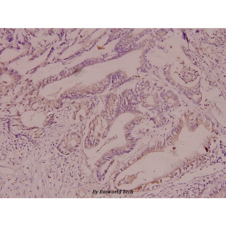 Anti-CaMKIα (S173) Antibody from Bioworld Technology (BS1728) - Antibodies.com