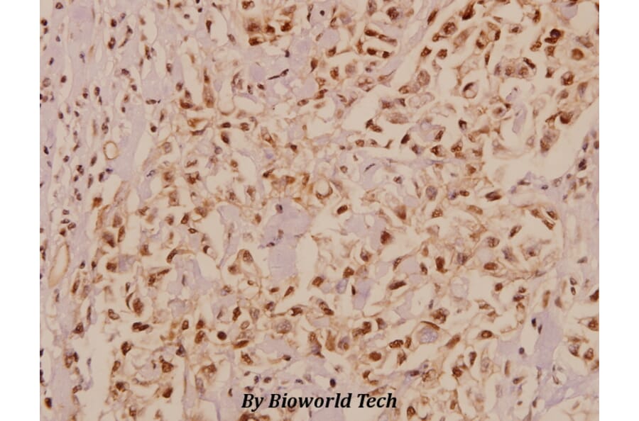 Anti-CaSR (A884) Antibody from Bioworld Technology (BS1729) - Antibodies.com