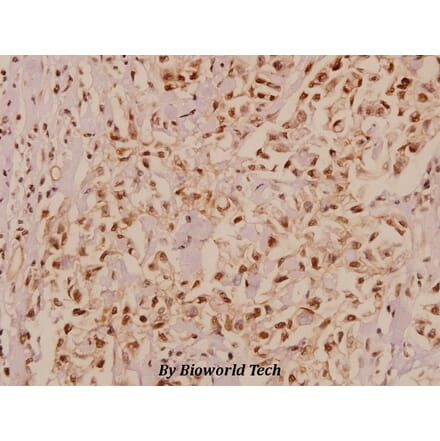 Anti-CaSR (A884) Antibody from Bioworld Technology (BS1729) - Antibodies.com