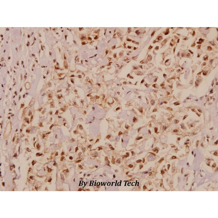 Anti-CaSR (A884) Antibody from Bioworld Technology (BS1729) - Antibodies.com