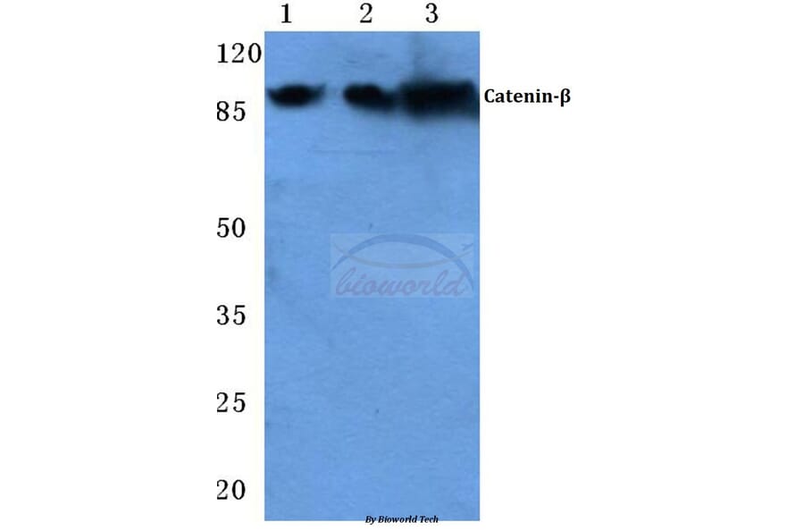 Anti-Catenin-β (G650) Antibody from Bioworld Technology (BS1732) - Antibodies.com