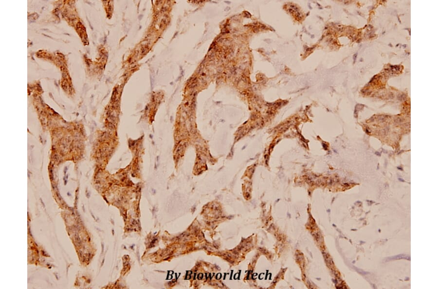 Anti-Catenin-β (G650) Antibody from Bioworld Technology (BS1732) - Antibodies.com