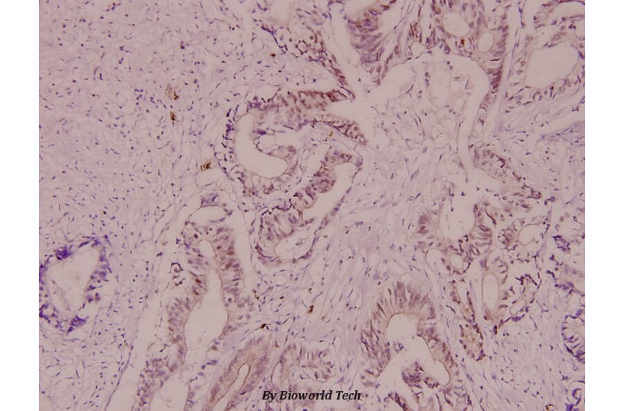 Anti-Crystallin-αB (S41) Antibody from Bioworld Technology (BS1738) - Antibodies.com