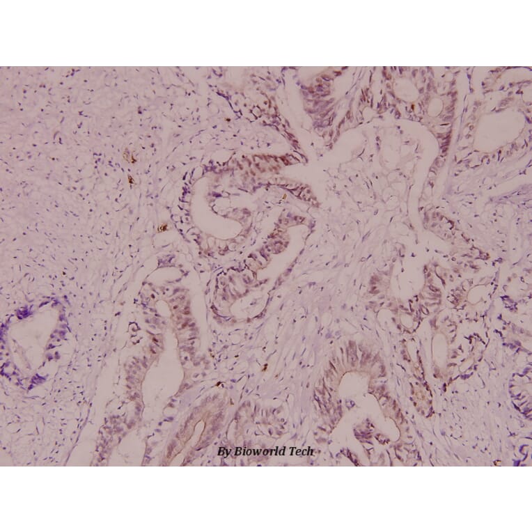 Anti-Crystallin-αB (S41) Antibody from Bioworld Technology (BS1738) - Antibodies.com