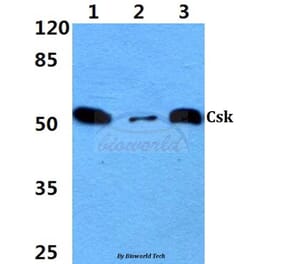 Anti-Csk (L558) Antibody from Bioworld Technology (BS1739) - Antibodies.com