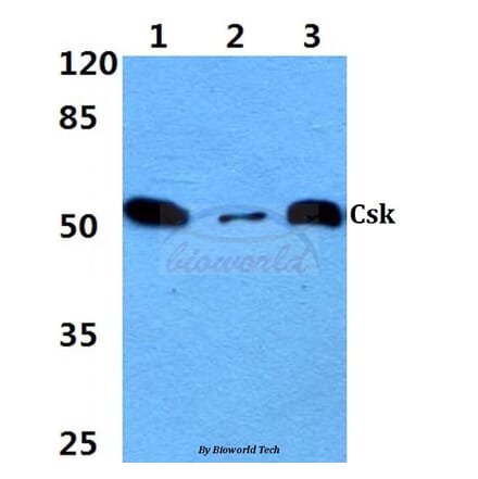 Anti-Csk (L558) Antibody from Bioworld Technology (BS1739) - Antibodies.com