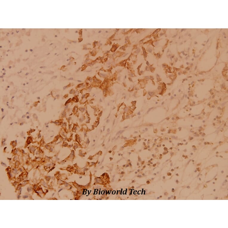 Anti-Csk (L558) Antibody from Bioworld Technology (BS1739) - Antibodies.com