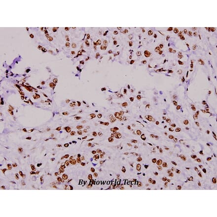 Anti-ERF (E520) Antibody from Bioworld Technology (BS1744) - Antibodies.com