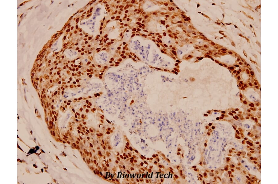 Anti-FKHR/FoxO1 (T323) Antibody from Bioworld Technology (BS1746) - Antibodies.com