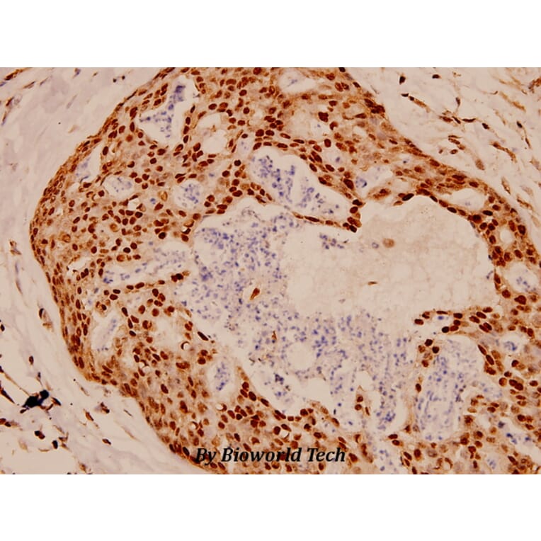 Anti-FKHR/FoxO1 (T323) Antibody from Bioworld Technology (BS1746) - Antibodies.com