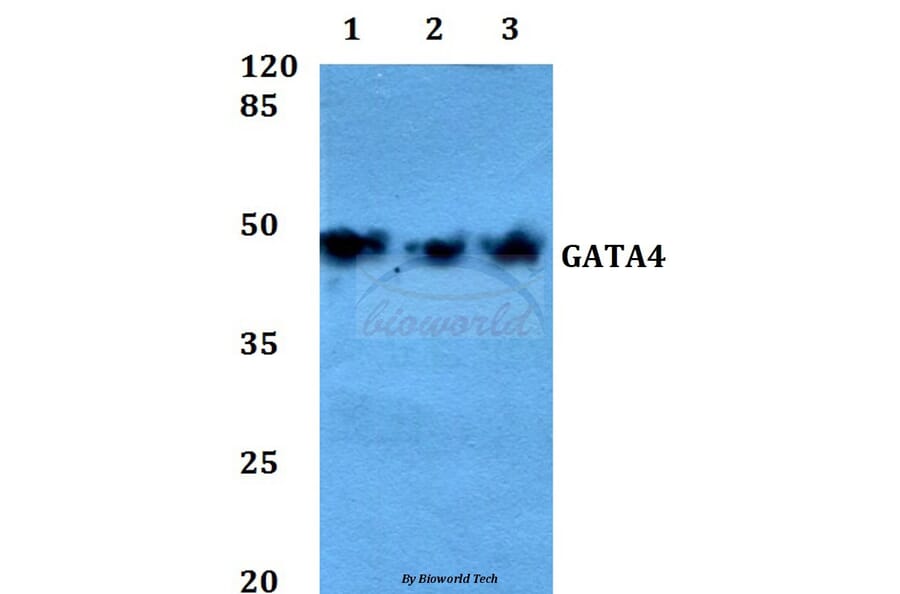 Anti-GATA4 (P101) Antibody from Bioworld Technology (BS1747) - Antibodies.com