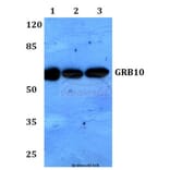 Anti-GRB10 (L63) Antibody from Bioworld Technology (BS1748) - Antibodies.com