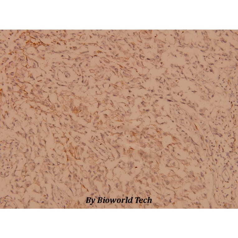 Anti-hnRNP C1/2 (G256) Antibody from Bioworld Technology (BS1753) - Antibodies.com