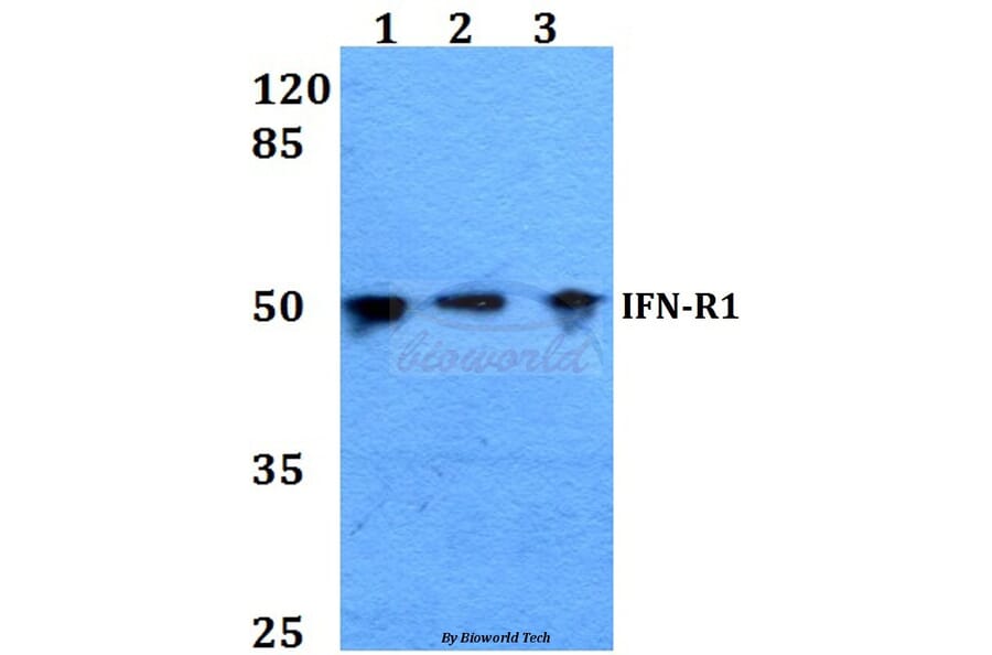 Anti-IFN-R1 (L461) Antibody from Bioworld Technology (BS1754) - Antibodies.com