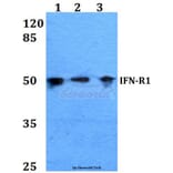 Anti-IFN-R1 (L461) Antibody from Bioworld Technology (BS1754) - Antibodies.com