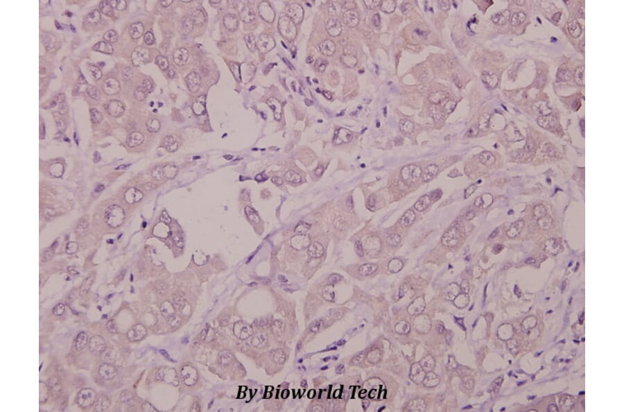 Anti-IFN-R1 (L461) Antibody from Bioworld Technology (BS1754) - Antibodies.com