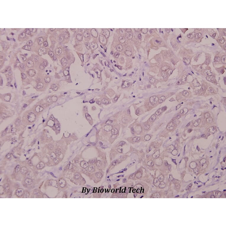 Anti-IFN-R1 (L461) Antibody from Bioworld Technology (BS1754) - Antibodies.com