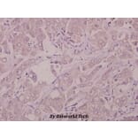 Anti-IFN-R1 (L461) Antibody from Bioworld Technology (BS1754) - Antibodies.com