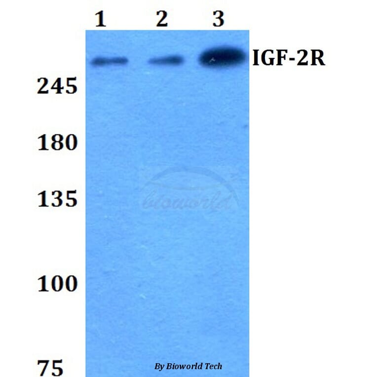Anti-IGF-2R (F2480) Antibody from Bioworld Technology (BS1755) - Antibodies.com