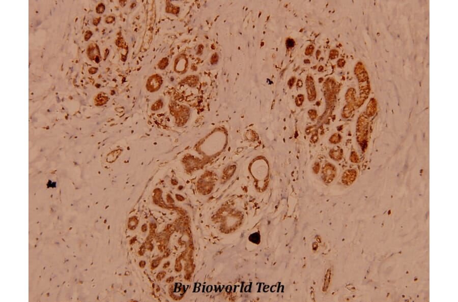 Anti-IKKα/β (Q174) Antibody from Bioworld Technology (BS1756) - Antibodies.com