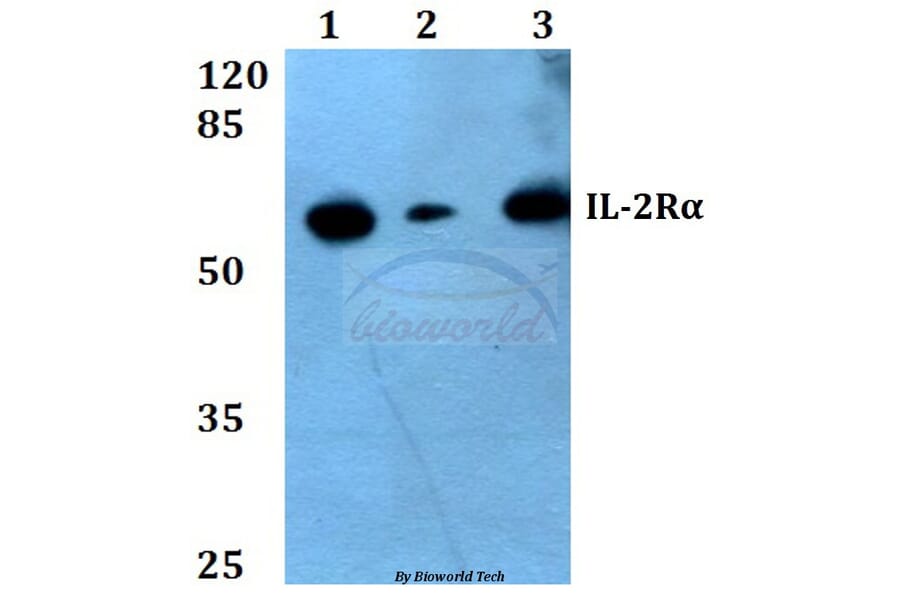Anti-IL-2Rα (R264) Antibody from Bioworld Technology (BS1758) - Antibodies.com