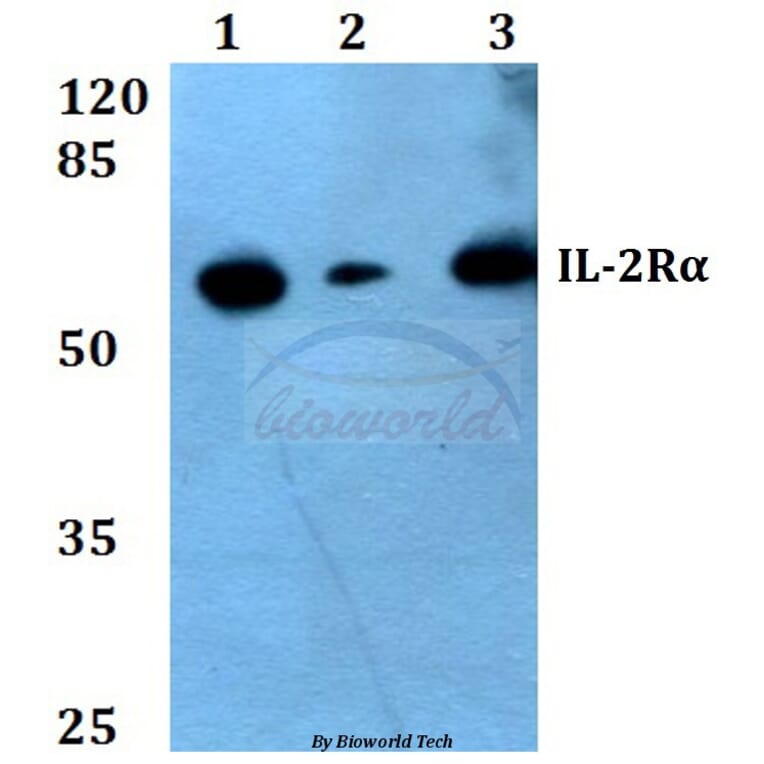 Anti-IL-2Rα (R264) Antibody from Bioworld Technology (BS1758) - Antibodies.com