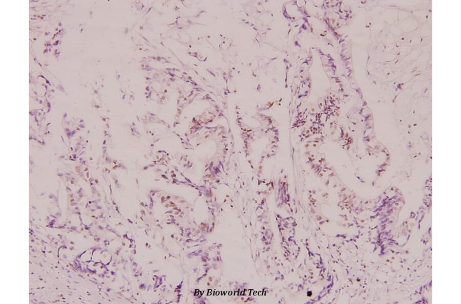Anti-IRP-1 (N707) Antibody from Bioworld Technology (BS1761) - Antibodies.com