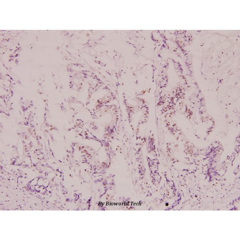 Anti-IRP-1 (N707) Antibody from Bioworld Technology (BS1761) - Antibodies.com