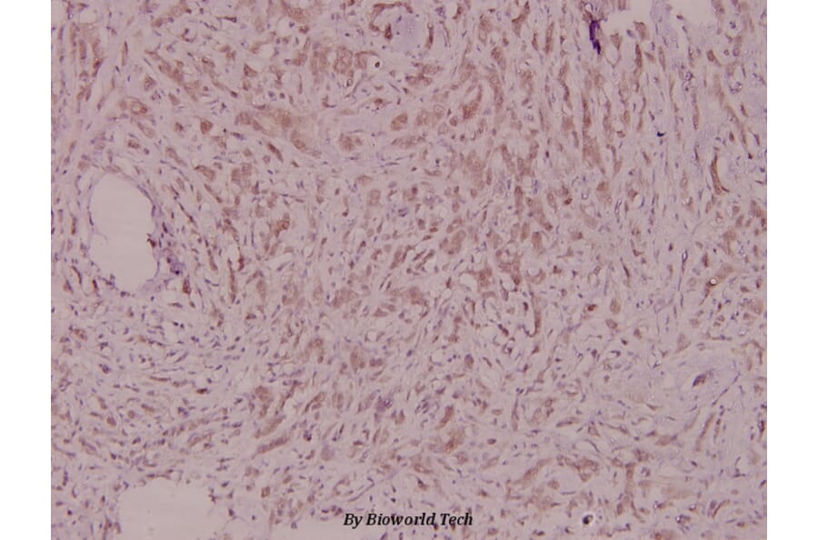 Anti-PDGFR-β (D1003) Antibody from Bioworld Technology (BS1763) - Antibodies.com