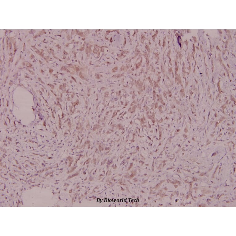 Anti-PDGFR-β (D1003) Antibody from Bioworld Technology (BS1763) - Antibodies.com
