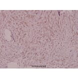 Anti-PDGFR-β (D1003) Antibody from Bioworld Technology (BS1763) - Antibodies.com