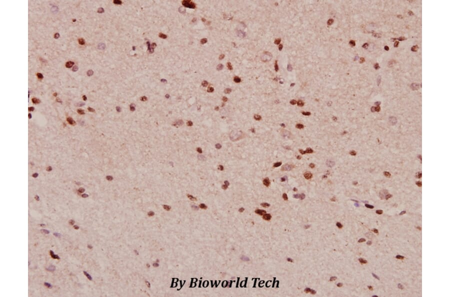 Anti-PDGFR-β (G1017) Antibody from Bioworld Technology (BS1764) - Antibodies.com