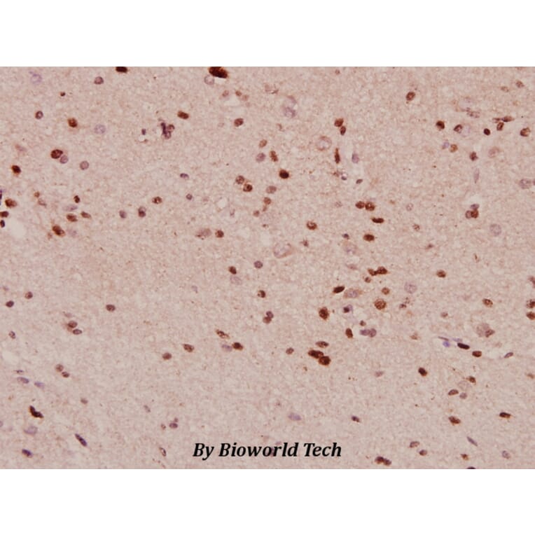 Anti-PDGFR-β (G1017) Antibody from Bioworld Technology (BS1764) - Antibodies.com