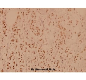 Anti-PP1α (G315) Antibody from Bioworld Technology (BS1765) - Antibodies.com