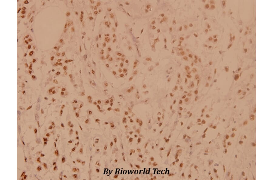 Anti-PP1α (G315) Antibody from Bioworld Technology (BS1765) - Antibodies.com