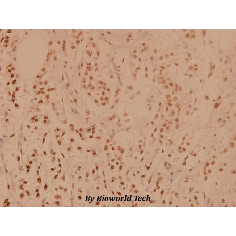 Anti-PP1α (G315) Antibody from Bioworld Technology (BS1765) - Antibodies.com