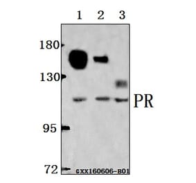 Anti-PR (A394) Antibody from Bioworld Technology (BS1766) - Antibodies.com
