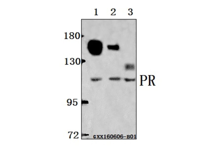 Anti-PR (A394) Antibody from Bioworld Technology (BS1766) - Antibodies.com